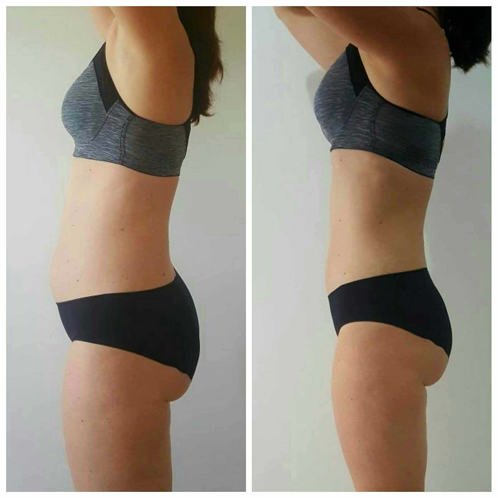 EMS Training Before and After with 15 sessions over 4 monthsg EMS Training Before and After with 15 sessions over 4 months